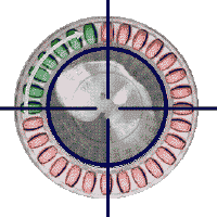 As mentiras dos governante: A "p�lula" n�o � o que diz os promotores dele